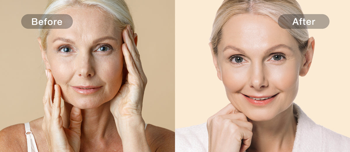 JOVS-reported firming comparison for the matching 4D model