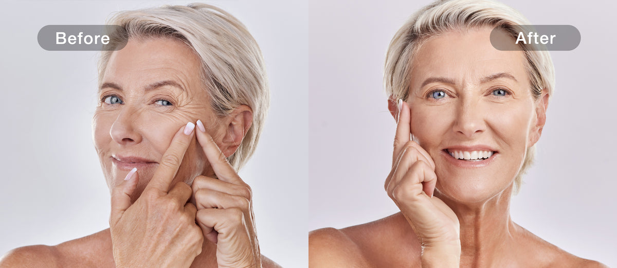 JOVS-reported glow comparison for the matching 4D model