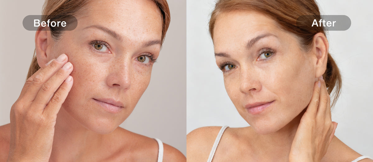 JOVS-reported spots comparison for the matching 4D model
